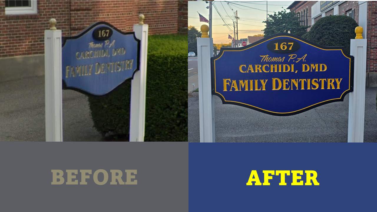 Before and After Dr Charchidi